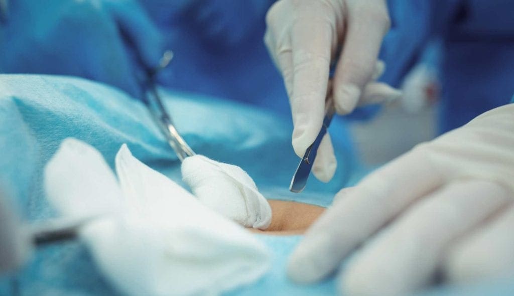 surgeon-with-scalpel-performing-operation-in-opera-N2Q568U