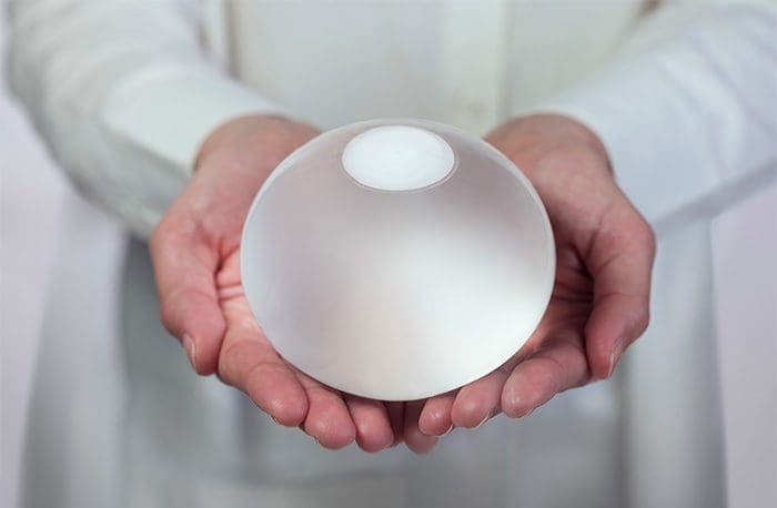 ORBERA-Female-Doctor-Holding-Balloon