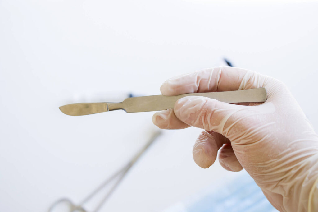 Closeup shot of a gloved hand holding a surgical scalpel